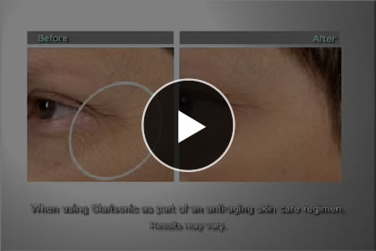 play video