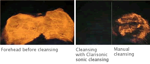 Clarisonic Cleansing- Before & After Photos