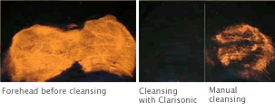 Clarisonic Cleansing - Before & After Photos
